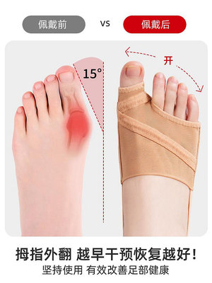 日本拇指外翻大母腳趾襪透氣糾正可以穿鞋分趾器
