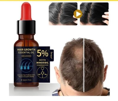 德利專賣店 買2送1 生薑王頭髮營養液養育頭髮根防止脫落控油5%Minoxidil精華液 現貨　滿300元出貨