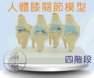 膝關節模型 【奇滿來】 膝關節退化性關節炎 膝關節鏡手術溝通 人體骨骼模型 教學模型 仿真模擬 醫生護士護理 ARDH
