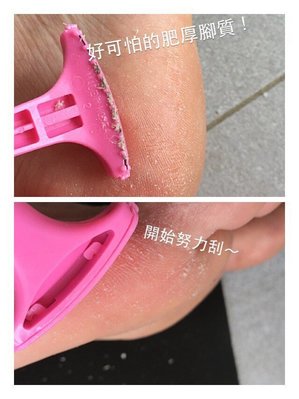 韓國製造 新款BALLET 專利不鏽鋼刮腳皮刀 去角質刀/刮腳皮器~~ 粉色現貨