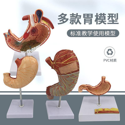 人體胃解剖模型 胃的病變模型 胃部疾病演示模型 病理胃 胃的穿孔