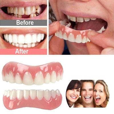 lnstant smile 上排+下排牙貼(亮白色) 美白牙貼 美齒牙套 矽膠假牙貼片 矽膠美齒貼 微笑假牙