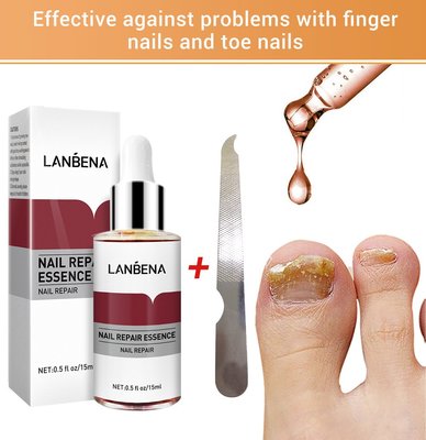 【萬家】LANBENA 藍蓓娜指甲修護液去灰指甲Nail Repair 12ml