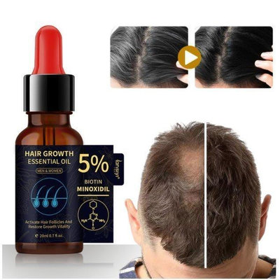 l樂樂代購 買2送1 生薑王頭髮營養液養育頭髮根防止脫落控油5%Minoxidil精華液