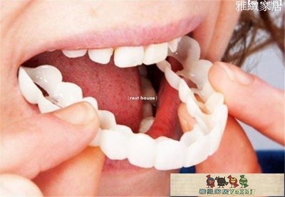 【熱賣精選】牙套吃飯神器吃飯用的咀嚼定型臨時牙齒硅膠仿真老人假牙門牙遮蓋BG203