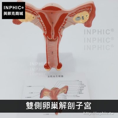 INPHIC-實驗道具女性生殖系統醫學模型婦產教學模型人體子宮解剖模型生教育演示器材-雙側卵巢解剖子宮_6yrs