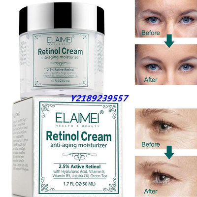 新店下殺折扣  Retinol Cream Retinol Cream Anti Aging Anti Wrinkle 黃醇面霜【元氣少女代購店】