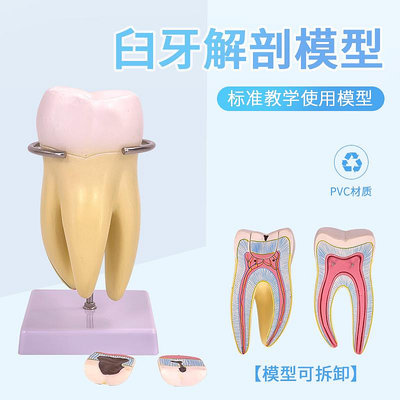 大型磨牙模型可拆卸牙髓蛀牙齲齒兒童牙列切牙尖牙口腔牙科用病理