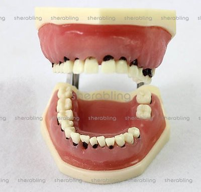 (ME-A233)口腔重度牙周病學模型牙結石刮治牙齦縫合模型分瓣