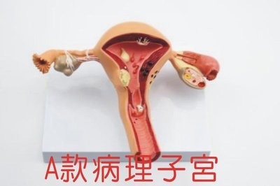 【奇滿來】A款 病理子宮模型 人體子宮模型 女性陰道模型 內外生殖器官 婦科醫學演示 醫學教學 ARDL
