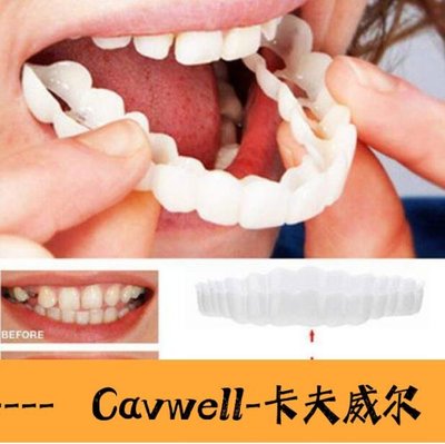 Cavwell-熱銷牙套發送鑷子牙套吃飯神器吃飯用的咀嚼定型臨時牙齒矽膠仿真老人假牙門牙遮蓋下標送鑷子-可開統編