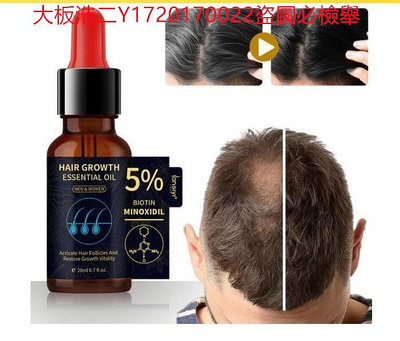 大板浩二 買2送1 生薑王頭髮營養液養育頭髮根防止脫落控油5%Minoxidil精華液 現貨