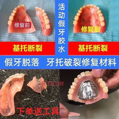 【】假牙膠水強力 膠粘接劑 牙齒脫落牙套斷裂老人牙托修復修補專膠水