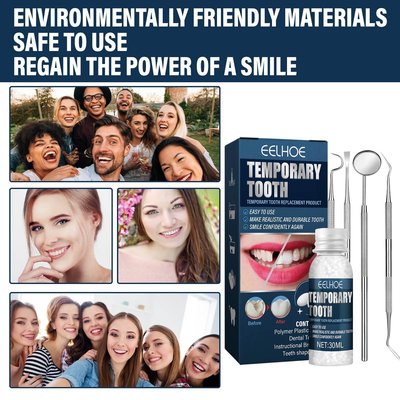 買二送一EELHOE補牙套裝 可塑修飾牙膠缺牙斷牙臨時補牙修復牙洞牙縫補齊