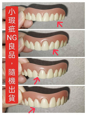 【福利品】自然色 上排牙貼 上排牙齒 矽膠假牙貼片 矽膠牙套 矽膠美齒貼 臨時假牙 美齒貼 仿真牙齒