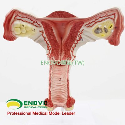 (ENOVO-078) 人體醫學女性子宮模型卵巢生殖結構解剖模型婦科婦產科
