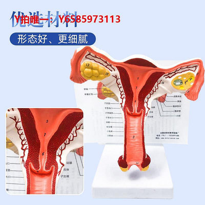 人體骨骼模型女性人體子宮解剖模型教具婦科雙側卵巢病理教學模具生殖正常病變