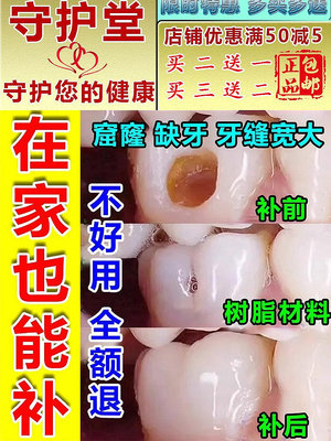補牙神器自己在家補牙堵牙洞3m進口樹脂補牙縫修復蛀牙自己填牙洞