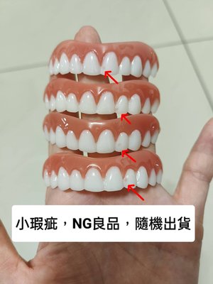 【福利品】上排牙貼(亮白色) 美白牙貼 美齒牙套 矽膠假牙貼片矽膠美齒貼 微笑假牙