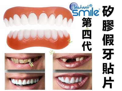 instant smile 第四代矽膠假牙貼片 補牙縫 填牙洞 臨時假牙 化妝補牙 牙片貼 遮蓋托 防磨牙 斷裂零時