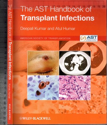 佰俐O《The AST Handbook of Transplant Infections》2011-Kumar