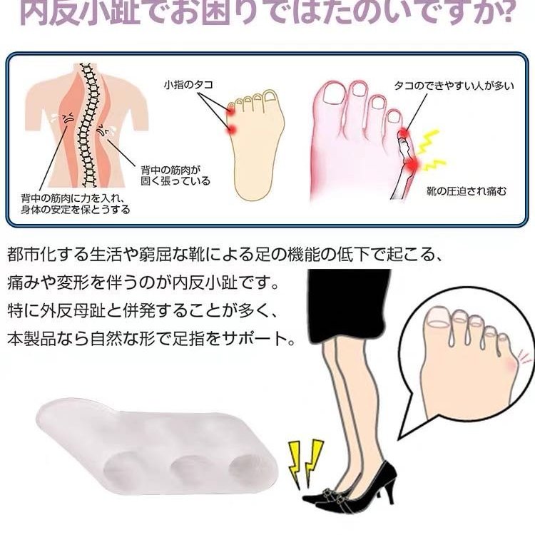 日本小趾外翻分趾套拇趾外翻小趾內翻日本腳趾分離器分趾器小拇趾分趾器小腳趾足趾環足趾套足趾器