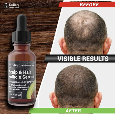 Dr. Berg毛囊精華液 含荷荷巴油和蓖麻油 13 種植物性全天然強健髮根 | 添加維生素 E 和 D 以增強效果