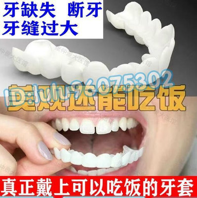 牙套美白牙套 吃飯神器 補牙 臨時假牙貼片 仿真牙齒 矽膠鍍膜 齙牙缺門牙縫遮蓋